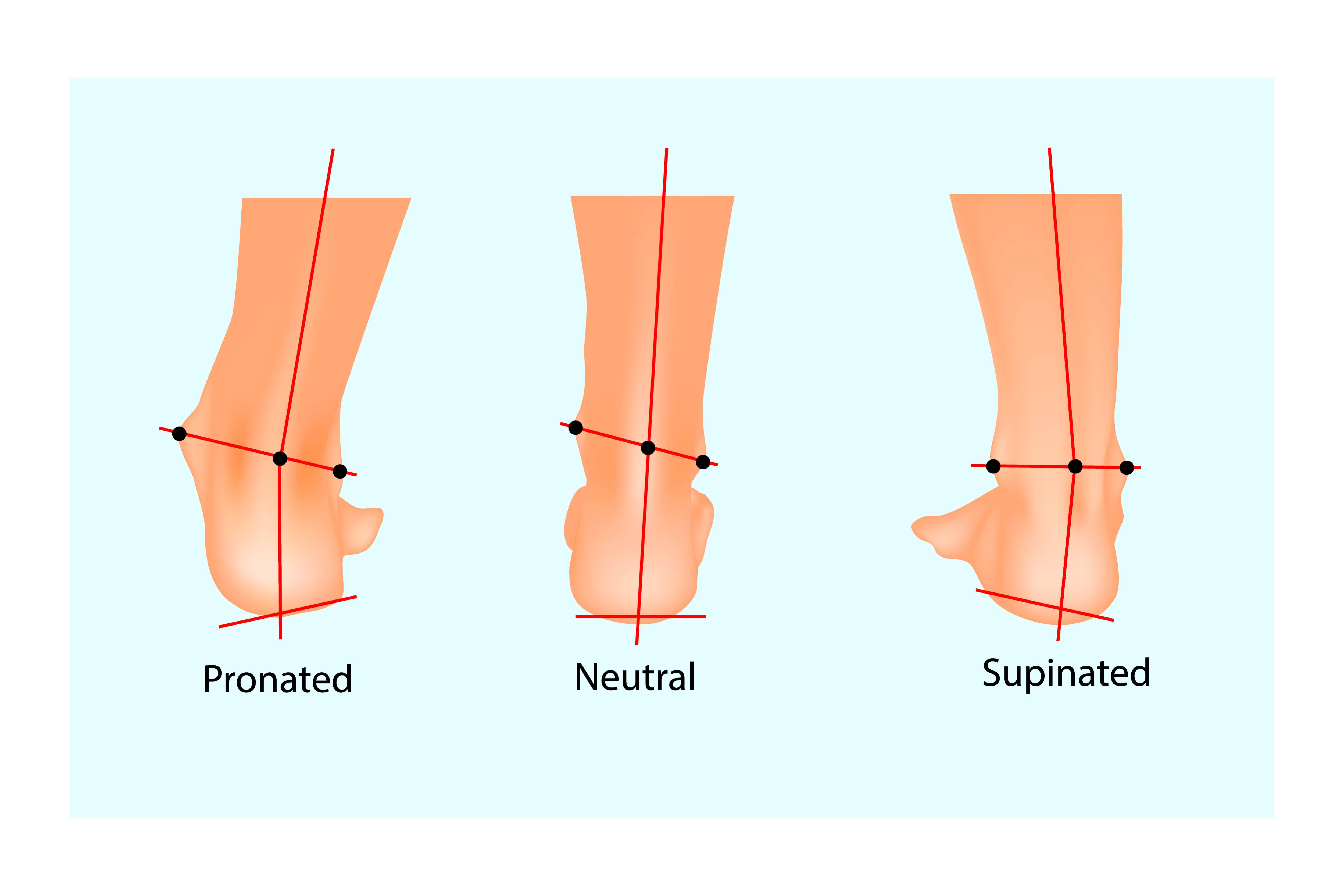 Slika predstavlja biomehaniko treh položajev stopala - pronacija, nevtralno in supinacija. 