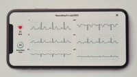 KardiaMobile 6L osebni EKG