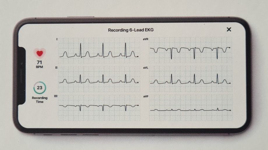 KardiaMobile 6L osebni EKG